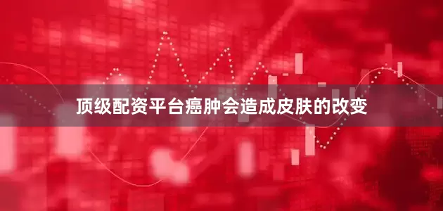 顶级配资平台癌肿会造成皮肤的改变